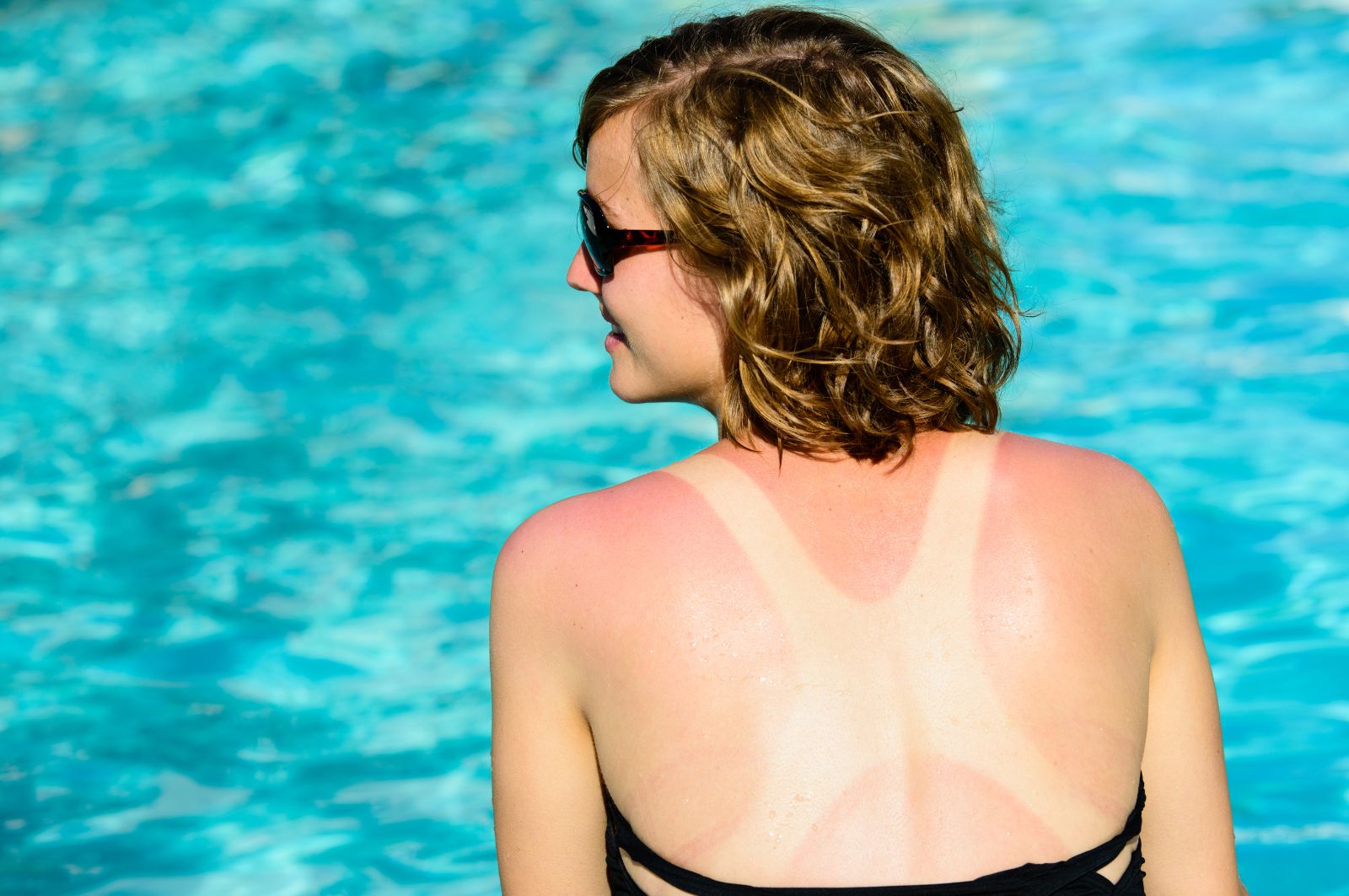 バリ島旅行の日焼け対策